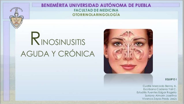 Rinitis Aguda Causas s ntomas tratamiento y m s